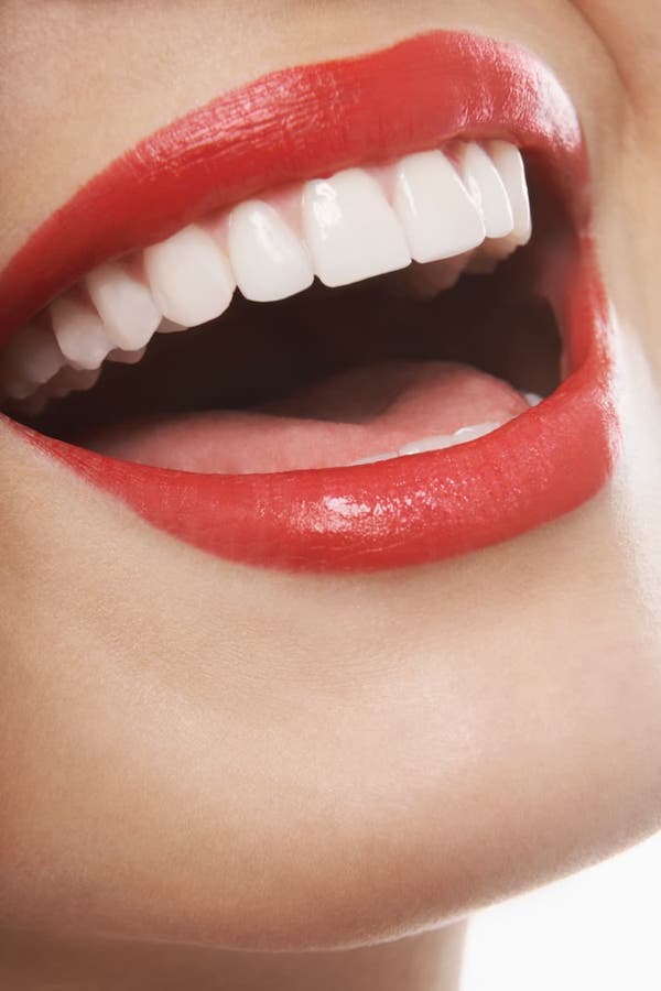 close-up-of-cosmetic-dental-veneers-los-angeles