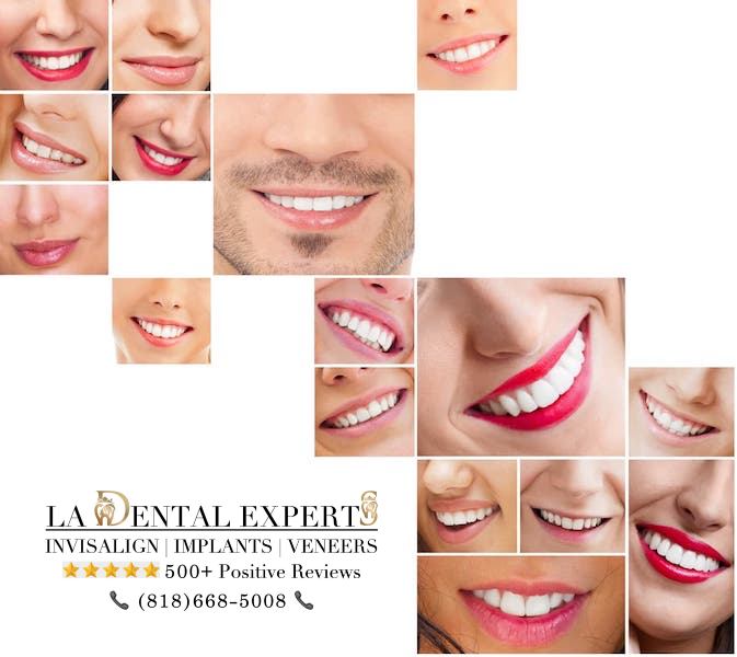 cosmetic-dentist-los-angeles-before-after-compilation