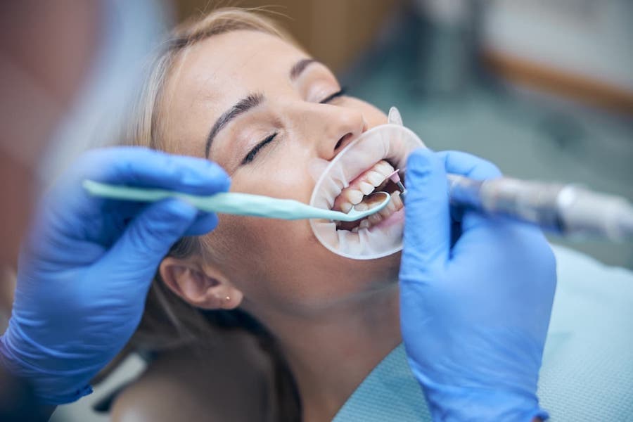 dental-bonding-los-angeles-on-young-woman
