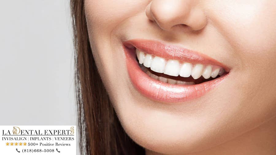 smile-of-best-model-for-los-angeles-cosmetic-dentist