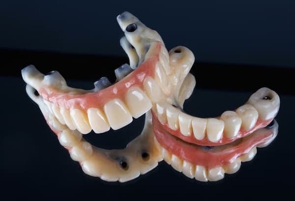 zygomatic-dental-implant-all-on-4-zirconia-dentures