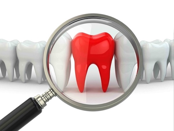 root-canal-prices-without-insurance-in-los-angeles-california-near-me