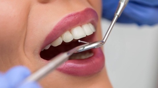 check-up-at-los-angeles-dentistry-clinic