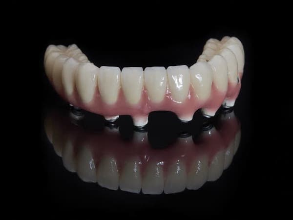 dentist-implant-dentures-los-angeles