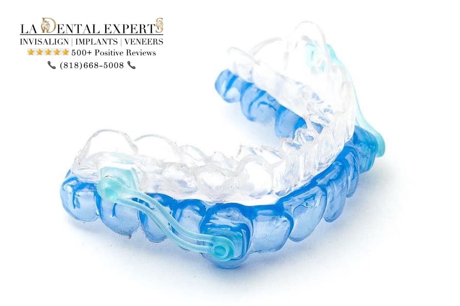 tmj-mouth-guard-los-angeles