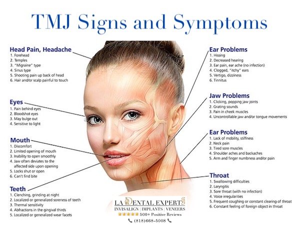 tmj-symptoms-los-angeles