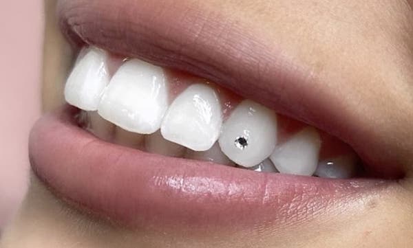 tooth-jewelry-price-los-angeles