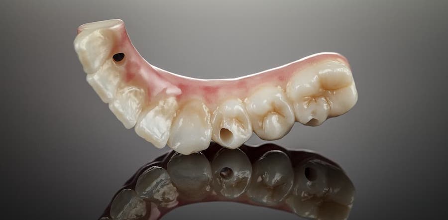dental-implant-prostheses-artificial-teeth