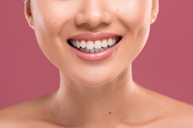 porcelain veneers