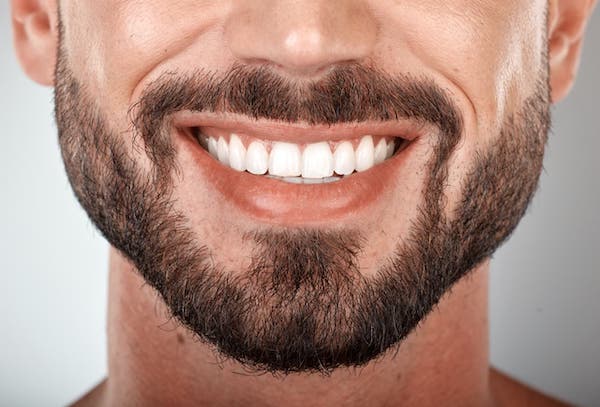 teeth-whitening-cost-beverly-hills